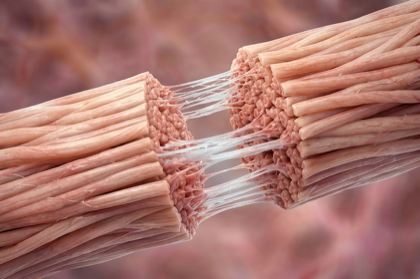 Tendon repair illustration